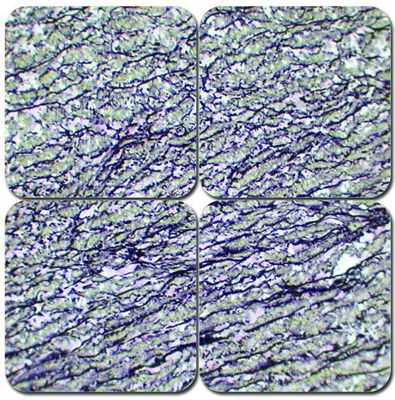 Elastic Stain Kit - Verhoeff's