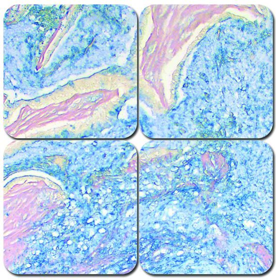 Colloidal Iron Stain Kit