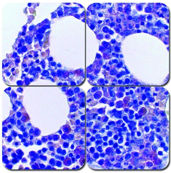 Giemsa/May-Grunwald Bone Marrow Stain Kit