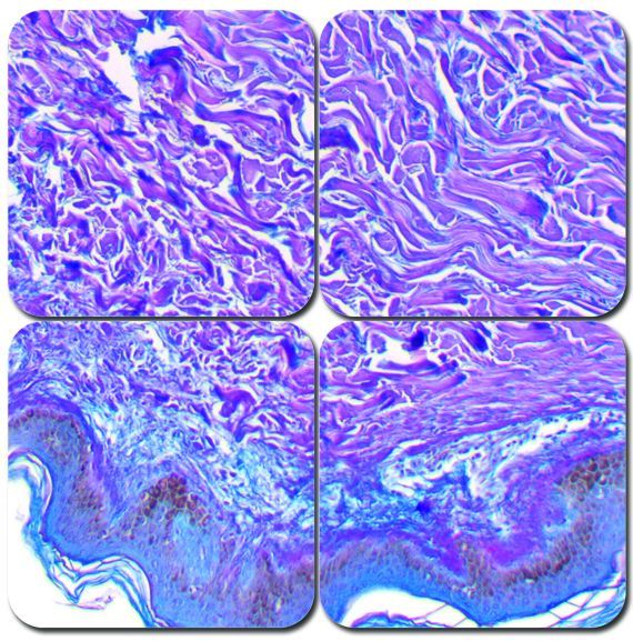 Herovici's Collagen Stain Kit