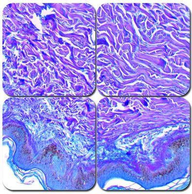 Herovici's Collagen Stain Kit Herovici's Collagen Stain Kit