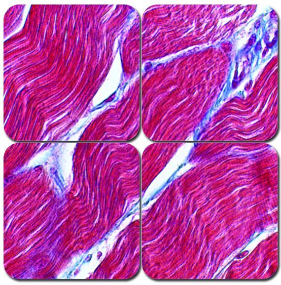 Trichrome Stain Kit - Masson's