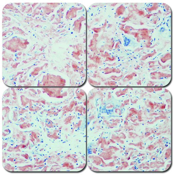 Alkaline Congo Red Amyloid Stain Kit