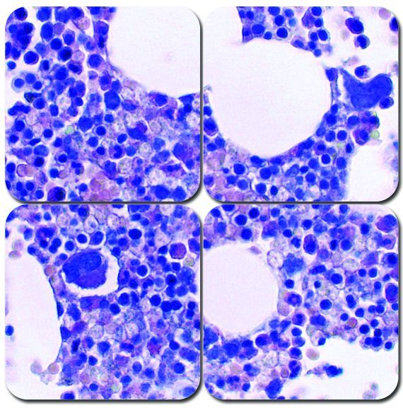 Giemsa Stain Kit, Optimized