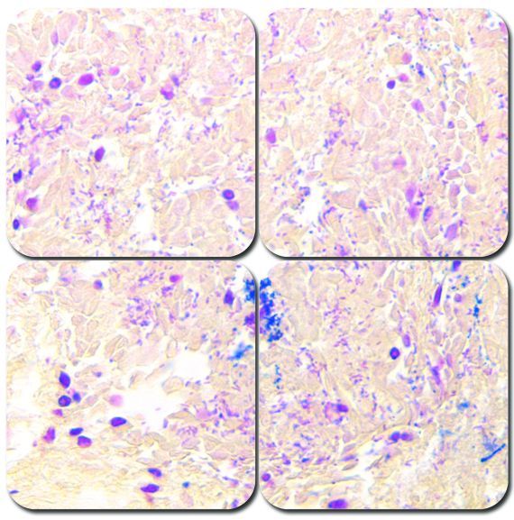 McDonald's Gram Stain Kit