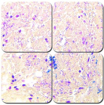McDonald's Gram Stain Kit McDonald's Gram Stain Kit