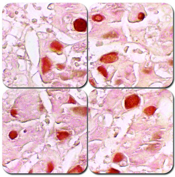 Hepatitis B Stain Kit