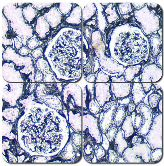 Jones Basement Membrane Reticulum Kit