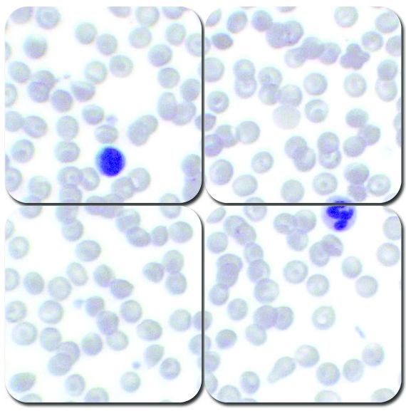 Wright-Giemsa Stain Kit