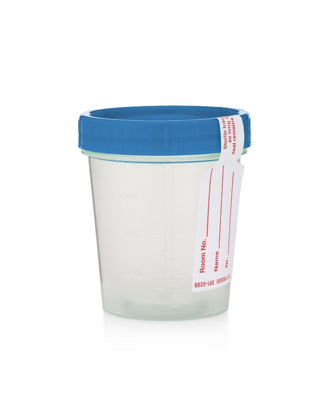 Sterile Screw Top Urine Specimen Containers