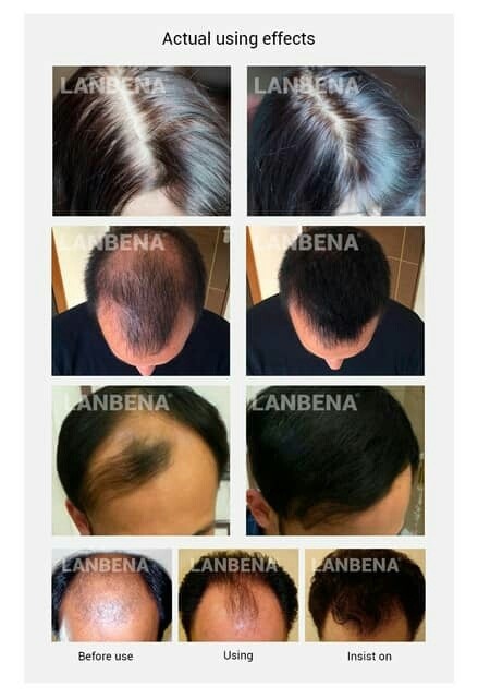 Lanbena hair growth essential oil