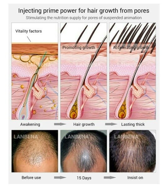 Lanbena hair growth essential oil