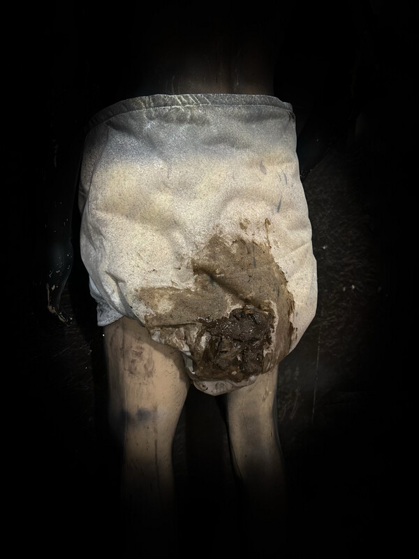 Dirty Diaper