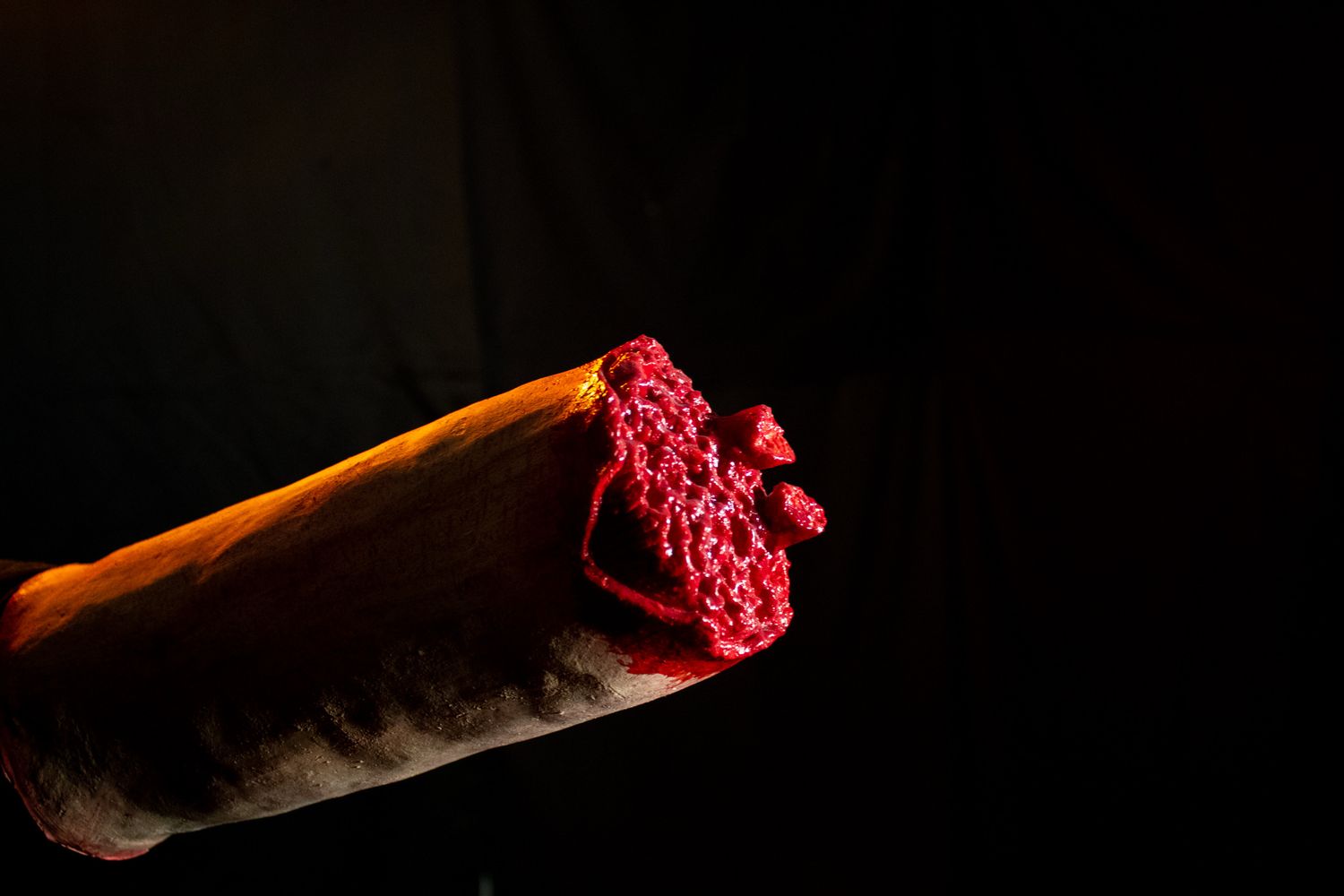 Stump Hand Prosthetic