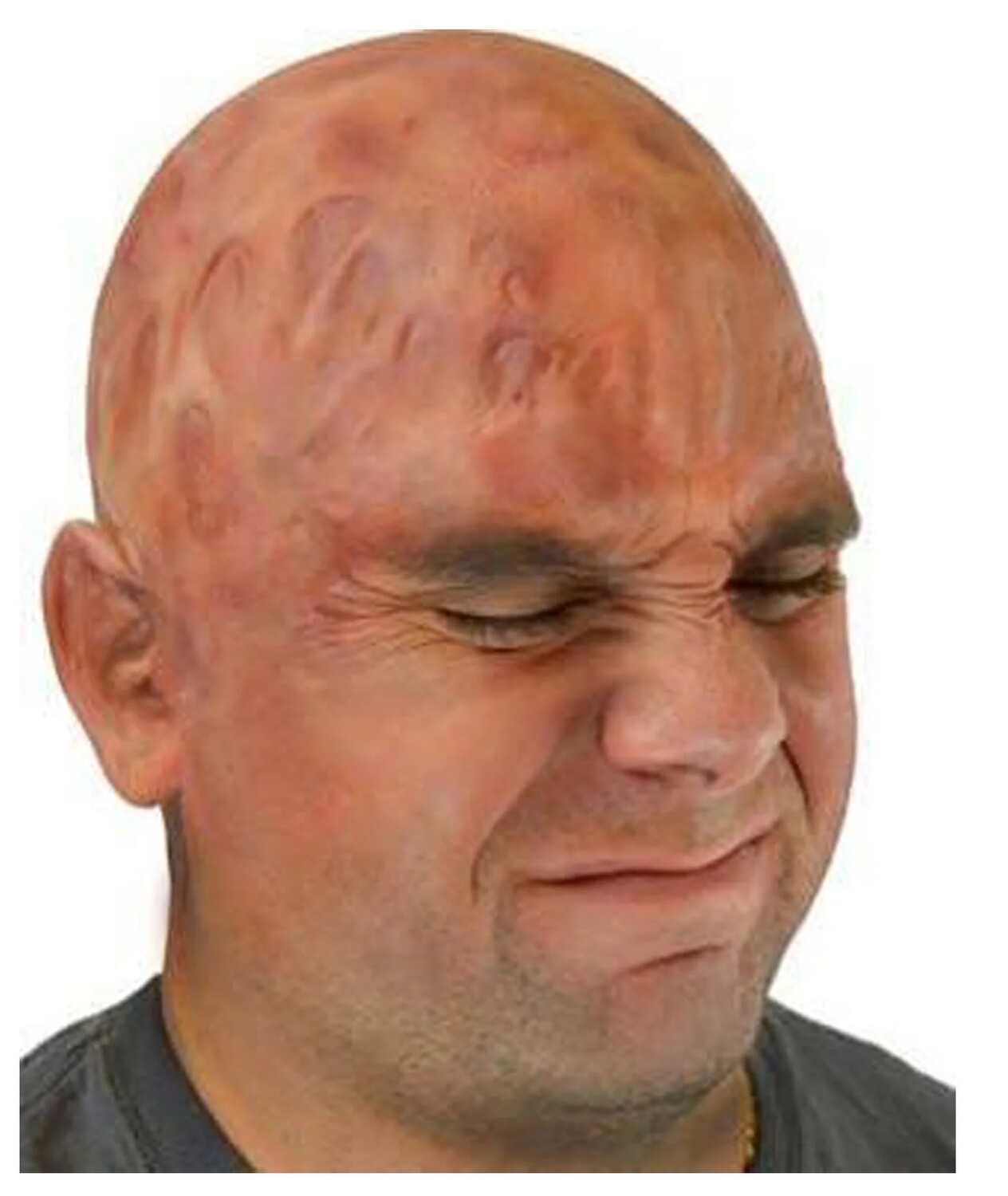 Woochie Burn Appliance Bald Cap