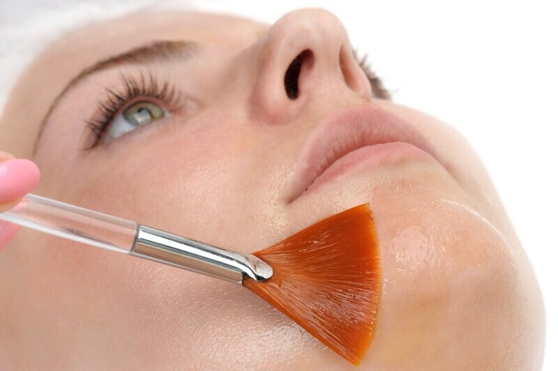 Peeling Chimique