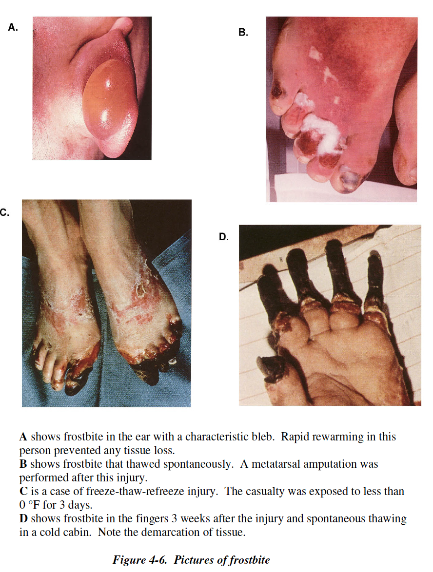 #1 Prevention and Management of Cold Weather Injuries BOOK #3 –– Download $2.00