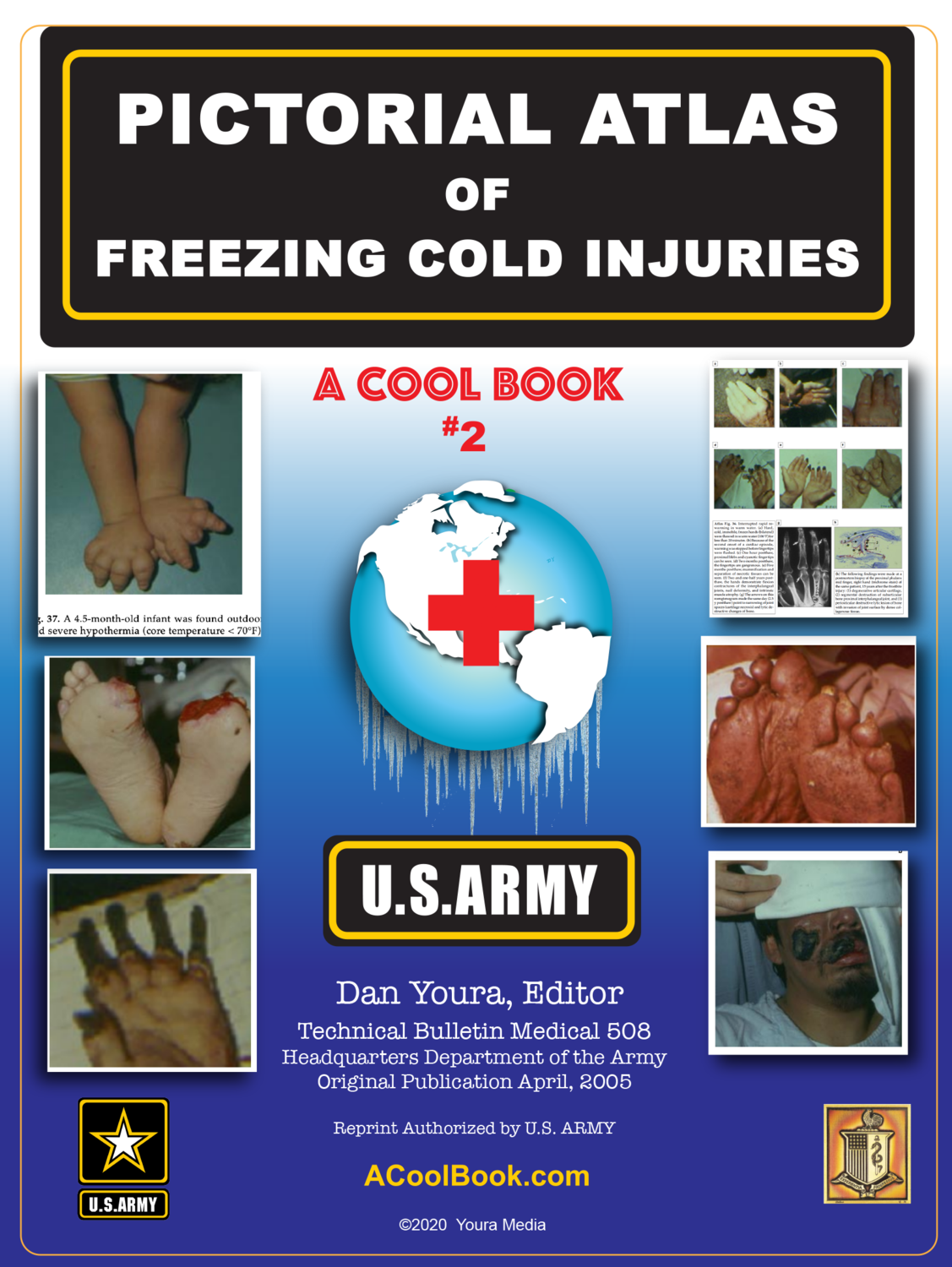 #1 Pictorial Atlas of Freezing Cold Injuries BOOK# 2 –– Download $2.00
