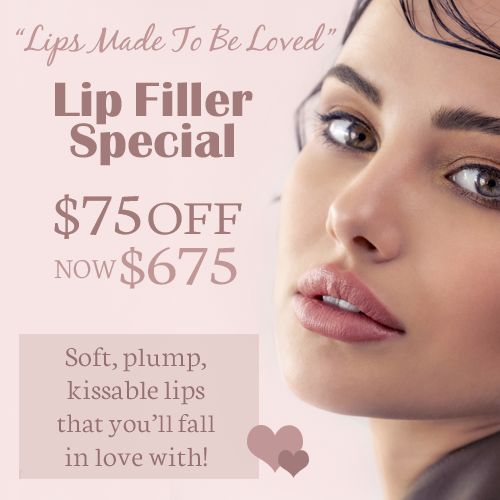 Lip Filler Special - $75 off!