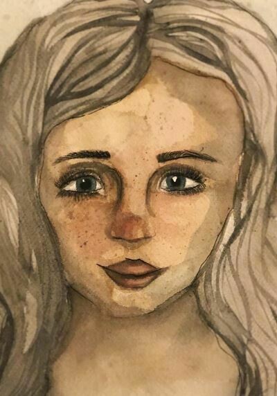 Freckles