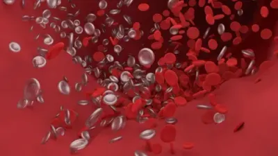Thrombose Hilfe Flush - Manuela Fasoli - 2021 Thrombose Hilfe Flush - Manuela Fasoli - 2021