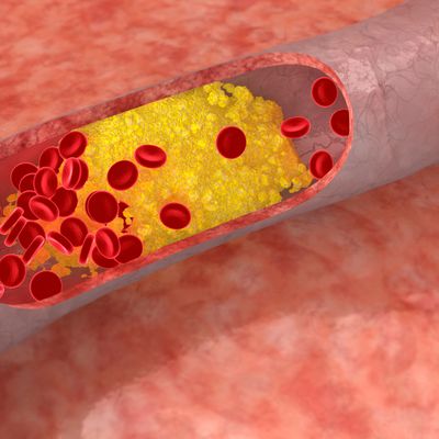 Cholesterin - Balance Energieflutungs Reiki -Silvia Opali Dentler - HANDBUCH IN DEUTSCHER SPRACHE