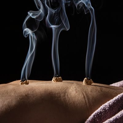 ÄTHERISCHE MOXIBUSTION - Mariah Windsong-Couture - HANDBUCH IN DEUTSCHER SPRACHE ÄTHERISCHE MOXIBUSTION - Mariah Windsong-Couture - HANDBUCH IN DEUTSCHER SPRACHE