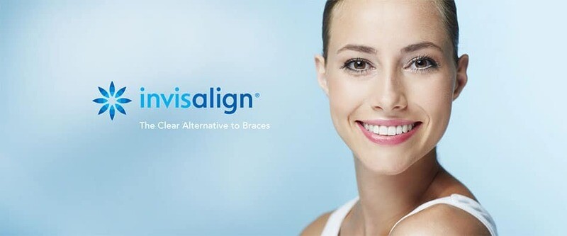 Lecture HCASYS Smart Invisalign