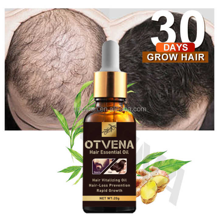 GUARANTEED HAIR LOSS TREATMENT- Otvena Essential Hair Oil