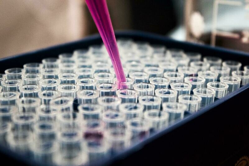 Food Sensitivity Testing