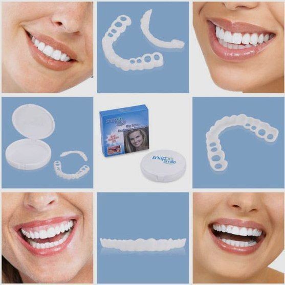 Hollywood Smile