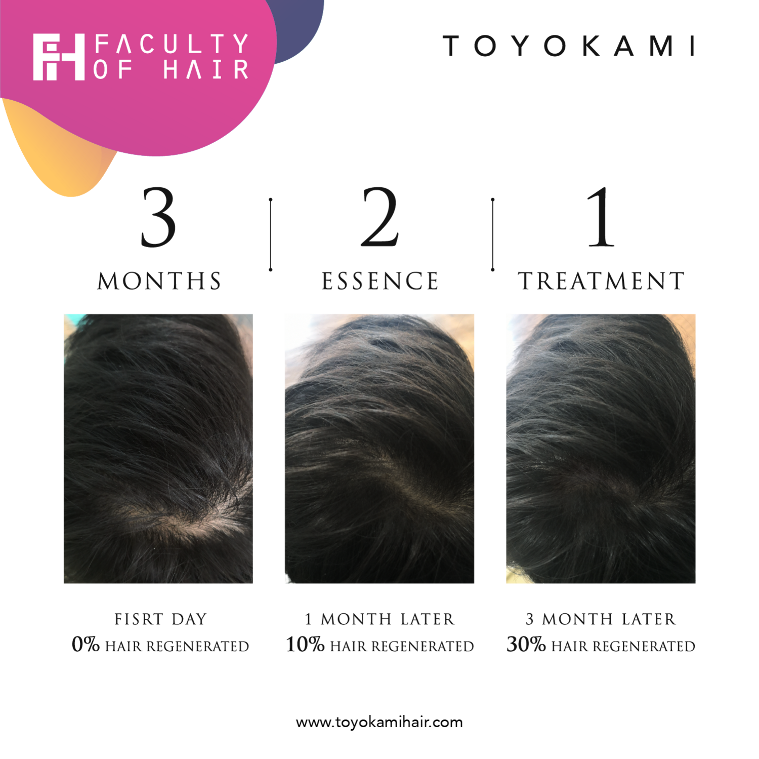 Toyokami Vitalmint Essence (Hair Loss/ Hair Thinning/ Hair Growth/ Hair Irritation/ Sensitive Scalp/ Hair Tonic) (By: Faculty of Hair)