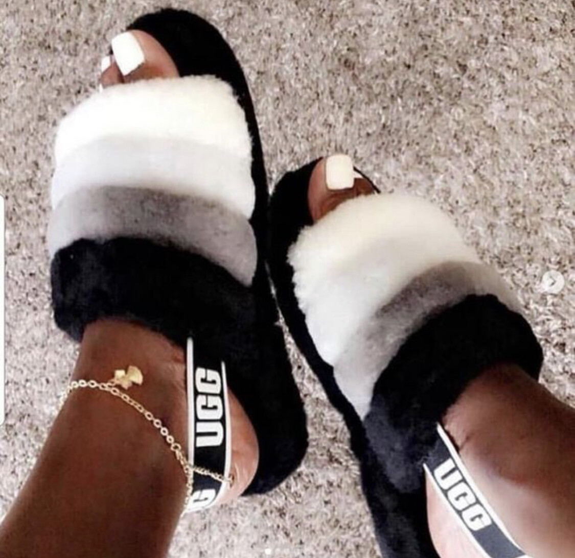 uggs fur slides