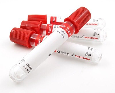 Red Top/Plain Tubes Vacuum Blood Collection Tubes