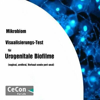 Visualisierungs-Test für urogenitale Biofilme Visualisierungs-Test für urogenitale Biofilme