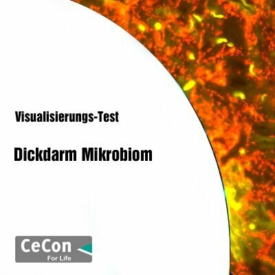 Visualisierungs-Test für Dickdarm-Mikrobiom Visualisierungs-Test für Dickdarm-Mikrobiom
