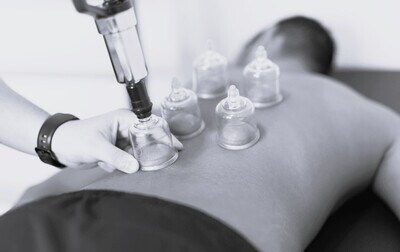 DRY CUPPING THERAPY