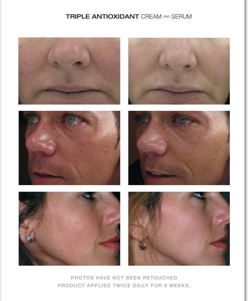 EuroLaser Triple Antioxidant Cream