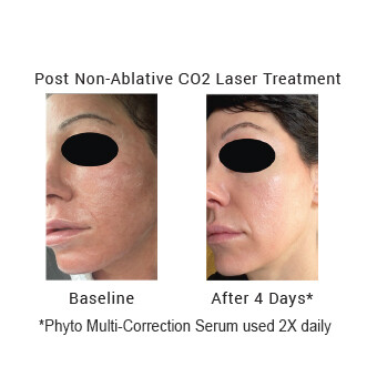 EuroLaser Phyto Multi-Correction Serum