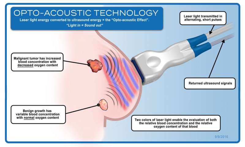 Seno Medical (United States)