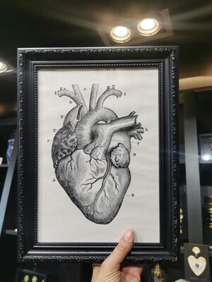 Cadre Coeur Anatomique Col Noir A4