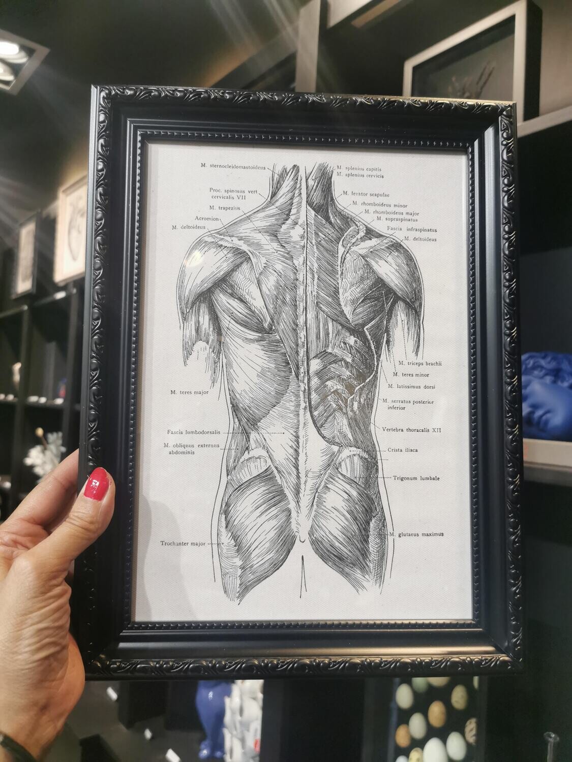 Cadre Anatomique Ecorché Dos Noir et Ecru A4