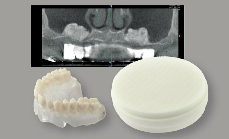 POLIDENT CAD-CAM DISC X-RAY POLIDENT CAD-CAM DISC X-RAY