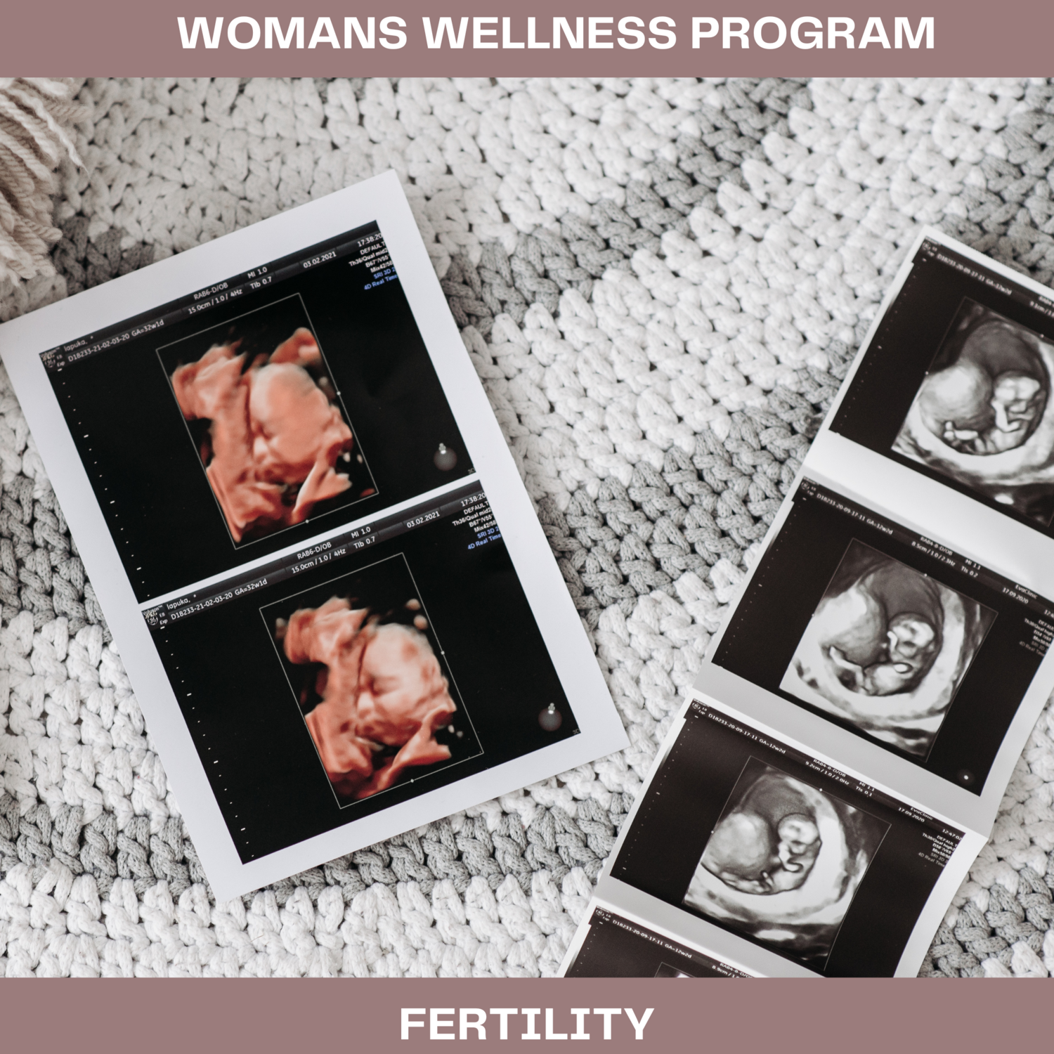 Womans Wellness Program  Fertility Program