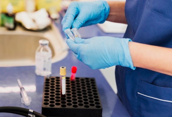 1 25 hidroxi vitamina d