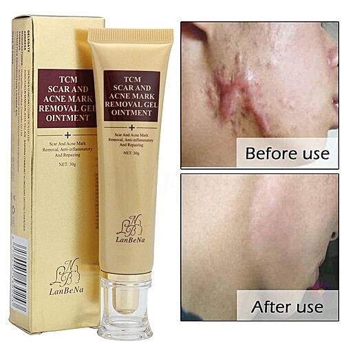 Lanbena TCM Scar &amp; Acne Removal Gel