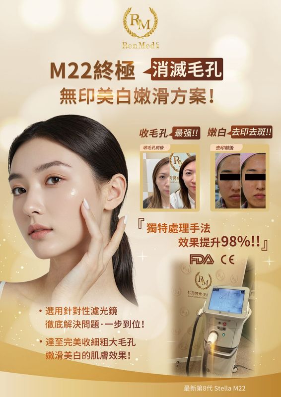 Stellar M22強效脈衝光嫩膚儀