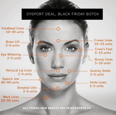 50 units of Botox or 75 units Dysport