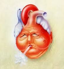 Congestive Heart Failure