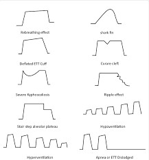 Capnography